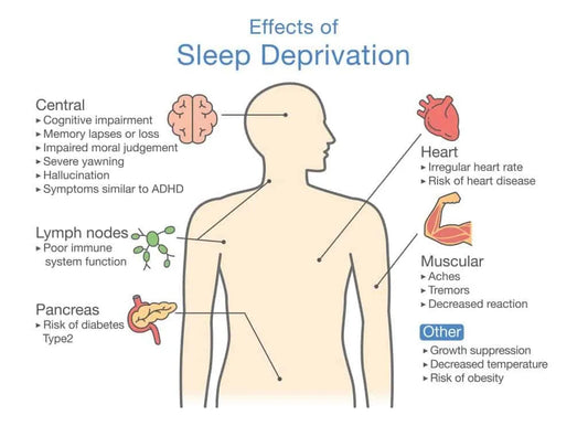 The Effects of Sleep Deprivation and the Benefits of Natural Sleep Aid Supplements